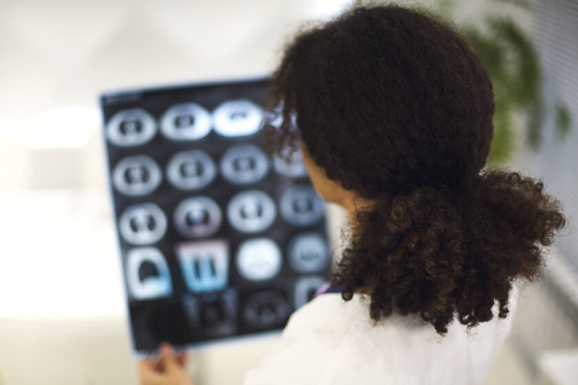 Rückansicht einer Ärztin, die während der Arbeit Röntgen-, MRT- oder CT-Untersuchungen analysiert