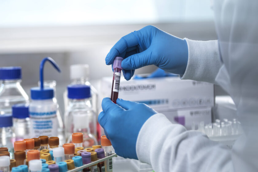 Eine Person in Laborkittel und blauen Latexhandschuhen hält ein Probenröhrchen mit Blut in den Händen.