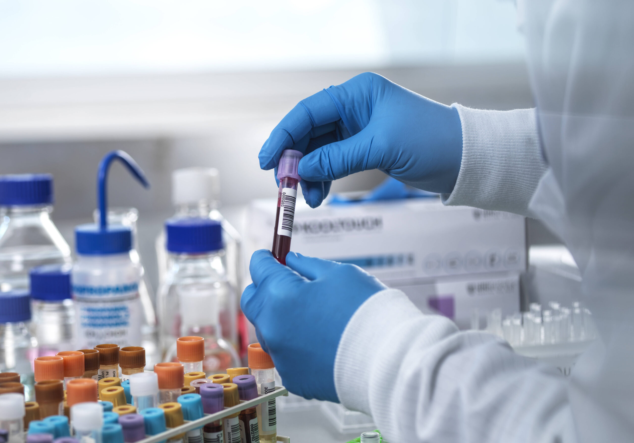 Eine Person in Laborkittel und blauen Latexhandschuhen hält ein Probenröhrchen mit Blut in den Händen.