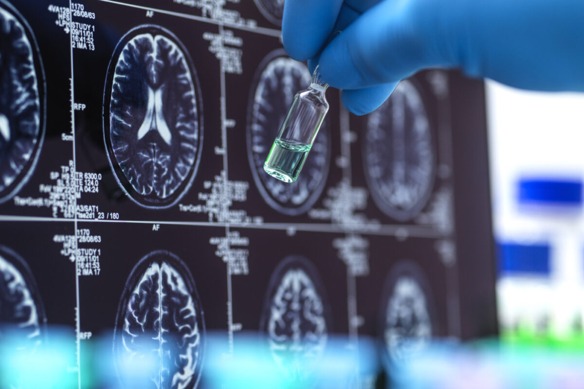 Hand of scientist developing new medicine near MRI scan on screen