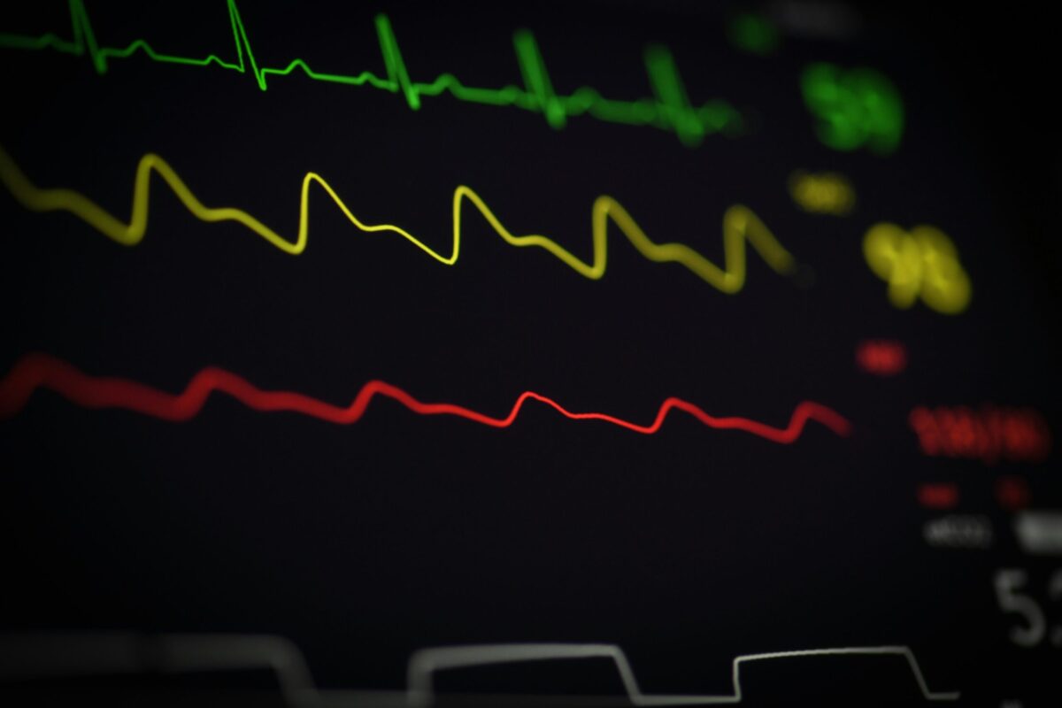 EKG Linien