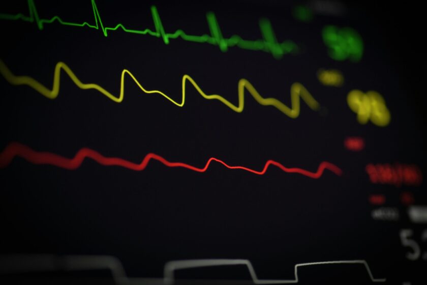 EKG Linien
